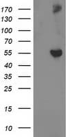 GBA3 / CBG Antibody (clone OTI5G3)