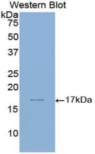 LAMA1 / Laminin Alpha 1 Antibody (aa2613-2746)