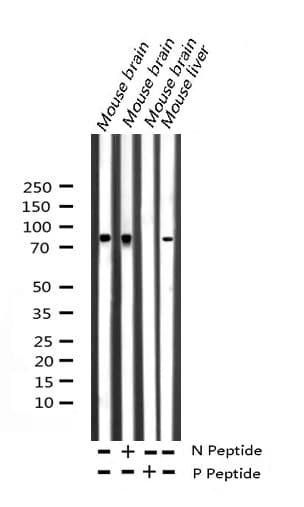 Polyclonal Rabbit anti-Human ATXN1 / SCA1 Antibody (phospho-Ser775, IF, WB)