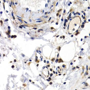 PKLR Antibody