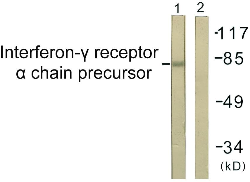 CD119 / IFNGR1 Antibody (p457)