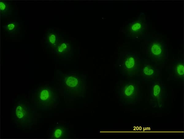 SMAD2 Antibody (clone 4D10)