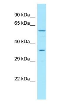 GPR35 Antibody (aa199-248)