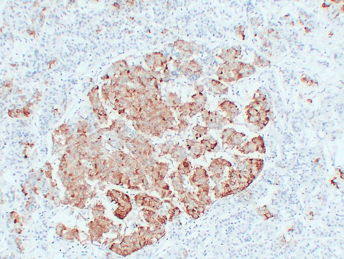 TSHB / TSH-Beta Antibody (clone ABT-TSH)