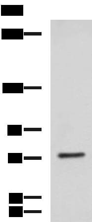 Polyclonal Rabbit anti-Human KIF2A Antibody (IHC, WB)