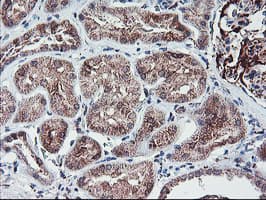 Monoclonal Mouse anti-Human PPP1R15A / GADD34 Antibody (clone OTI4F1, IHC, IF, WB)