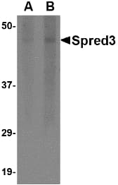 SPRED3 Antibody