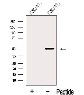 IGSF21 Antibody