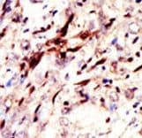 SUMO1 / SMT3 Antibody