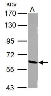 ME1 / Malate Dehydrogenase Antibody (aa161-519)