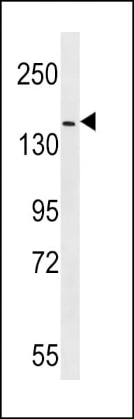 ERBB4 / HER4 Antibody (aa1141-1166)