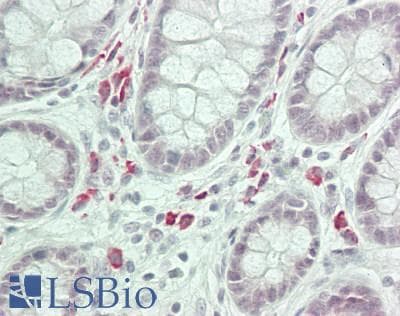 IHC-plus™ Polyclonal Rabbit anti-Human ANAPC7 / APC7 Antibody (aa515-565, IHC)