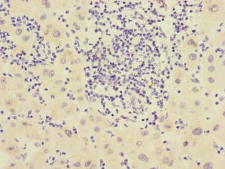 Polyclonal Rabbit anti-Human CHRNE Antibody (IHC)