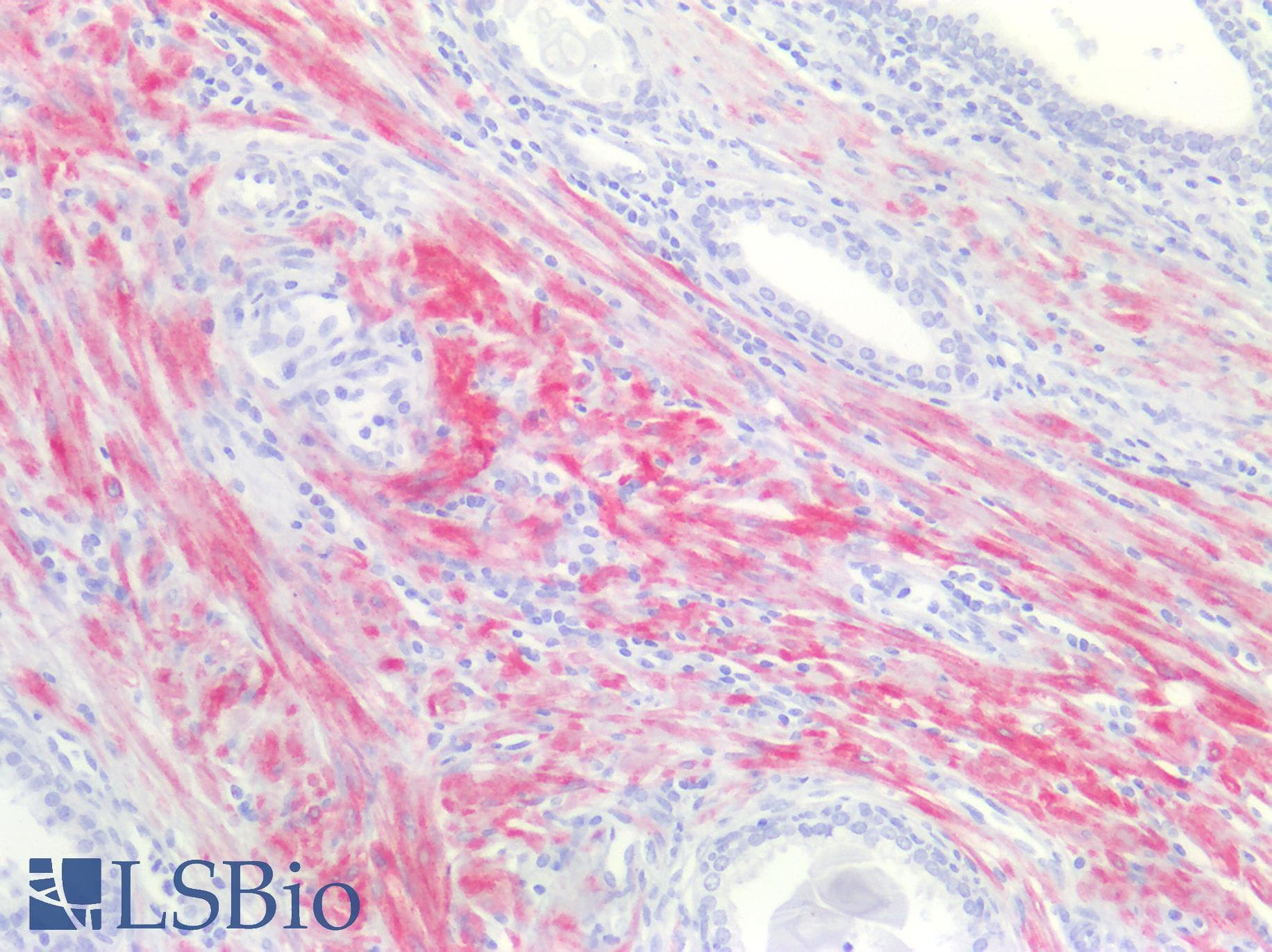 PathPlus™ Smoothelin Antibody (clone R4A)