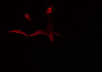 DNTT / TdT Antibody