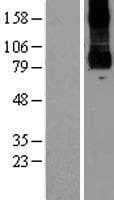 PKD2L1 Protein (Over-Expression Lysate Myc-DDK (Flag))