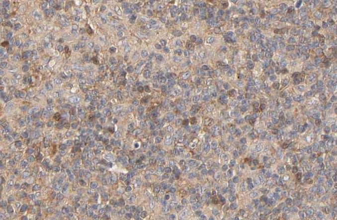 Polyclonal Rabbit anti-Human RPS6KB1 / P70S6K / S6K Antibody (phospho-Ser424, IHC, IF, WB)