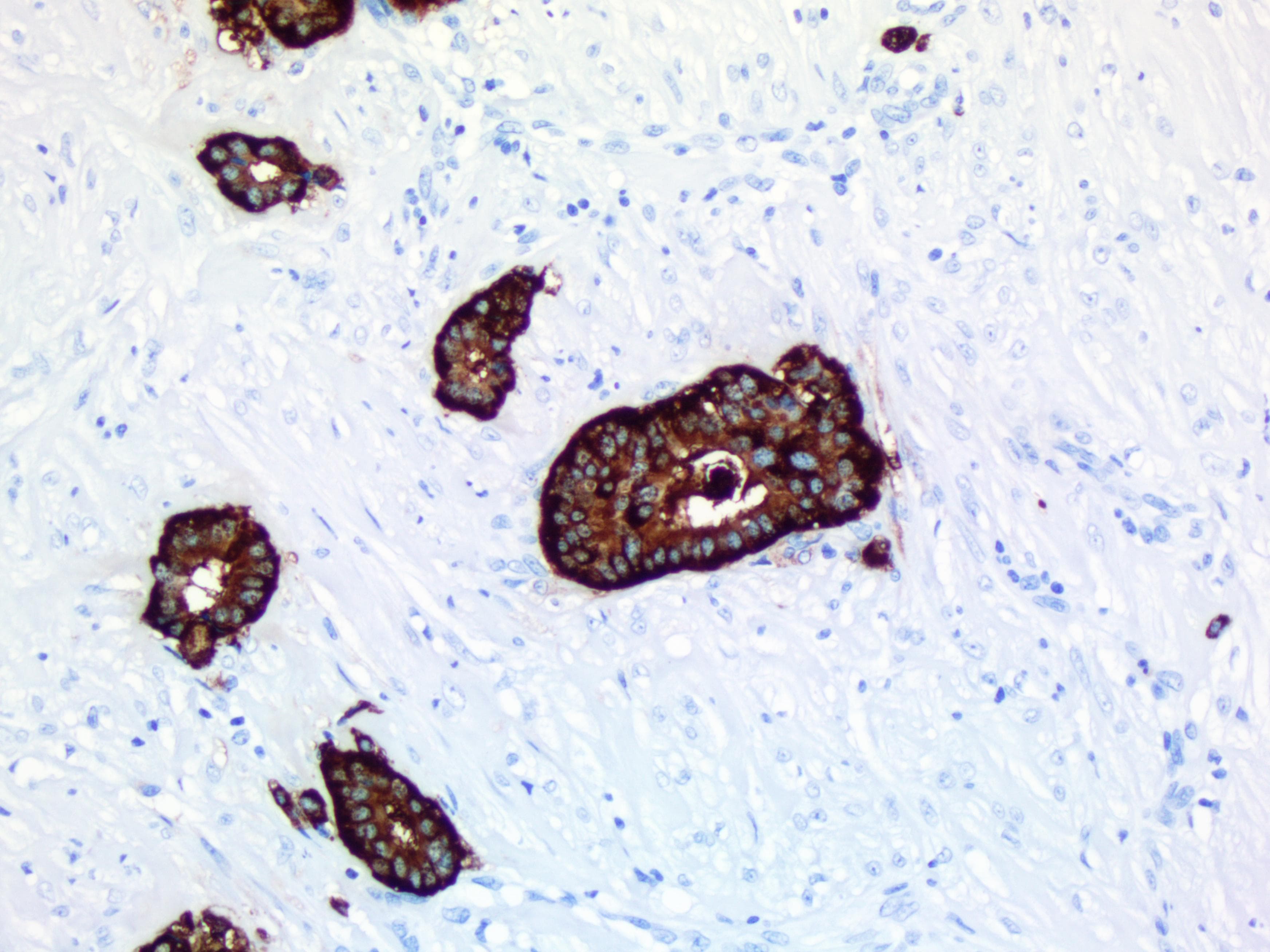 CHGA / Chromogranin A Antibody (clone UMAB109)