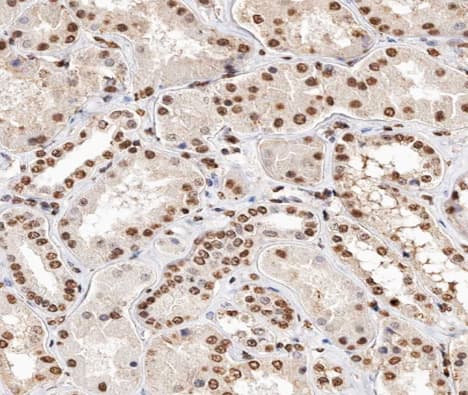 Histone H2A Antibody (phospho-Thr121)