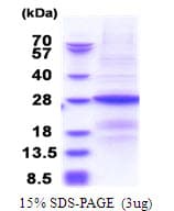 Human B9D1 Protein (Recombinant His)