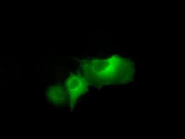 IHC-plus™ Monoclonal Mouse anti-Human DAPK2 / DAP Kinase 2 Antibody (clone 1B5, IHC, IF, WB)