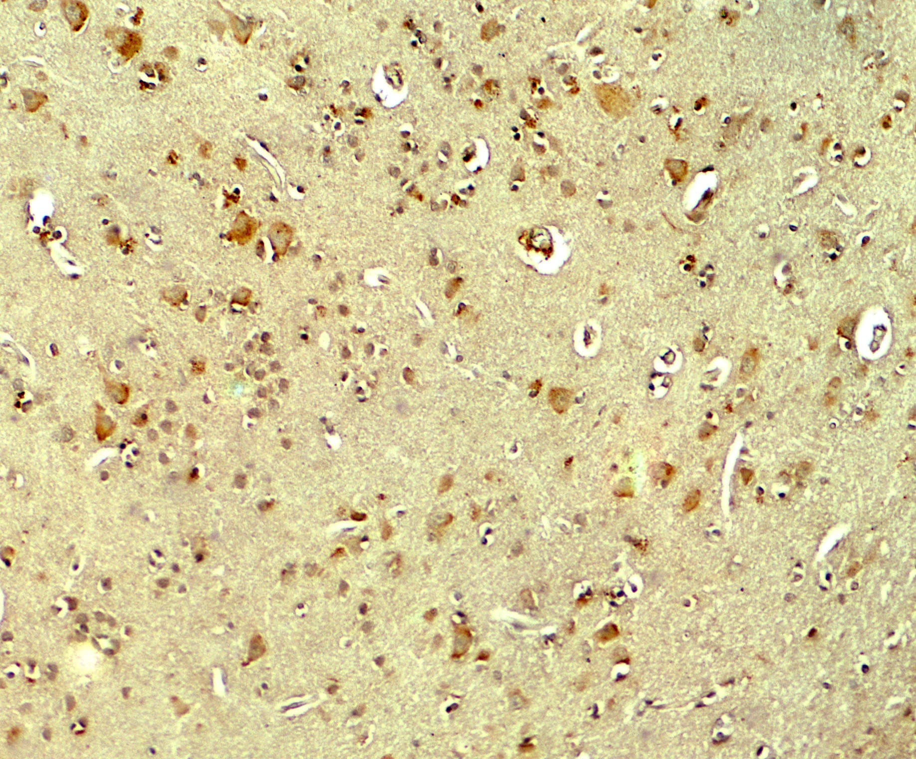 PARK2 / Parkin 2 Antibody