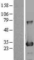 BDH2 Protein (Over-Expression Lysate Myc-DDK (Flag))