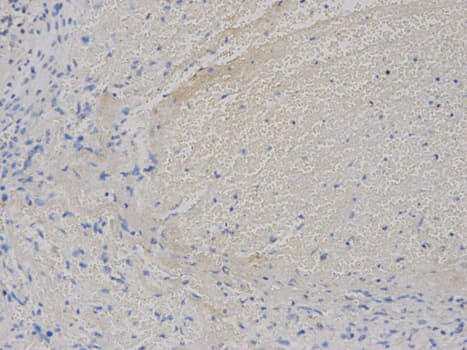 VEGFB Antibody
