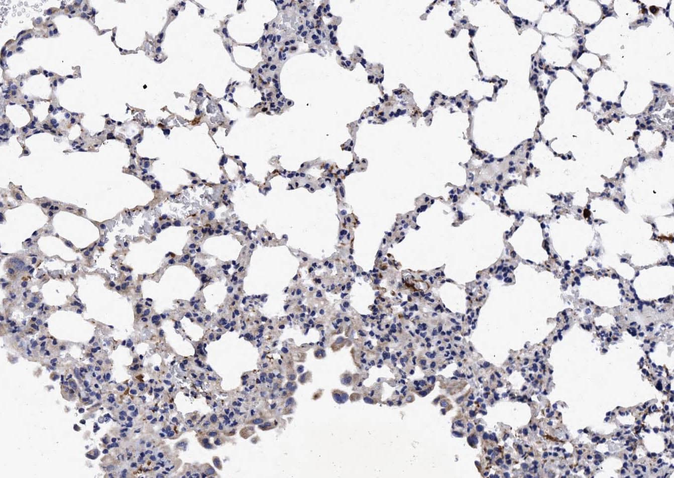 Polyclonal Rabbit anti-Human NCR1 / NKP46 Antibody (IHC, WB)