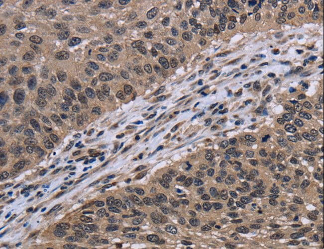 ITGAE / CD103 Antibody