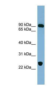 Polyclonal Rabbit anti-Human HCCS1 / VPS53 Antibody (aa431-480, WB)