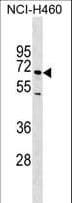 Polyclonal Rabbit anti-Human SELE / CD62E / E-selectin Antibody (WB)