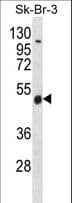 Polyclonal Rabbit anti-Human WDR34 Antibody (aa305-334, WB)