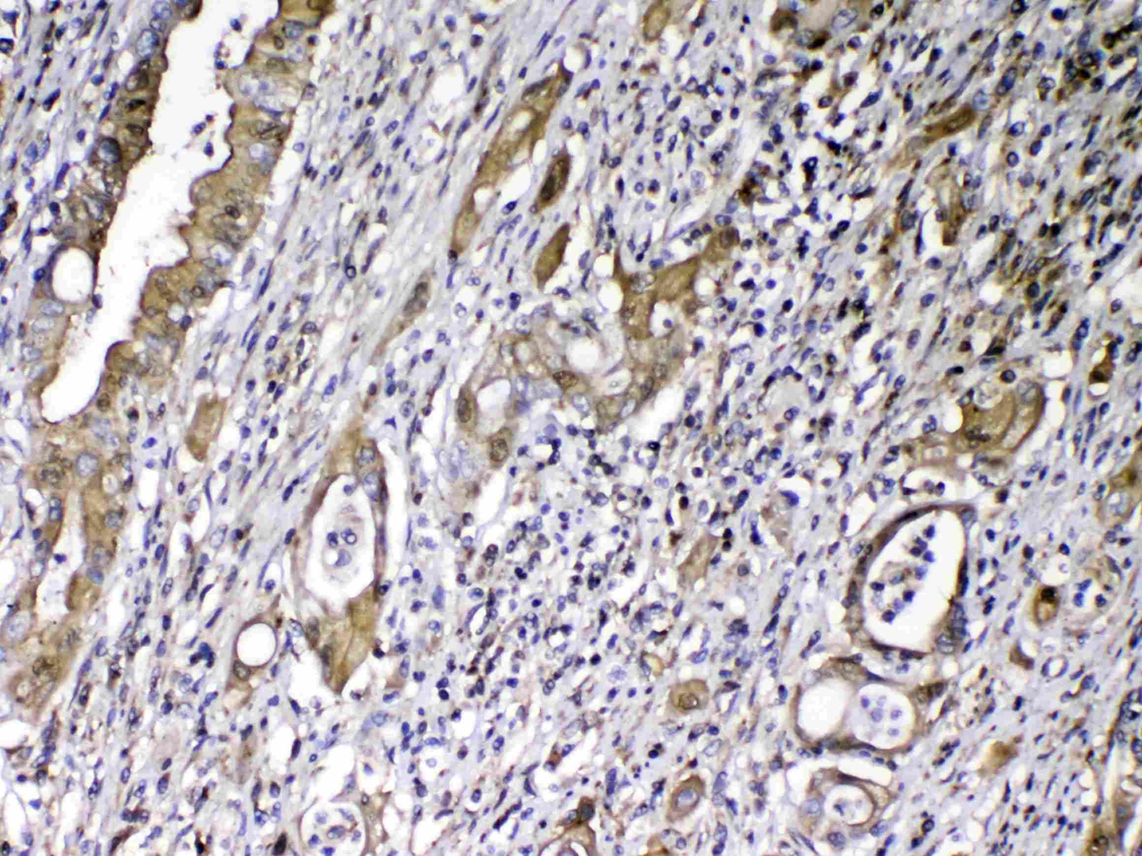 GC / Vitamin D-Binding Protein Antibody