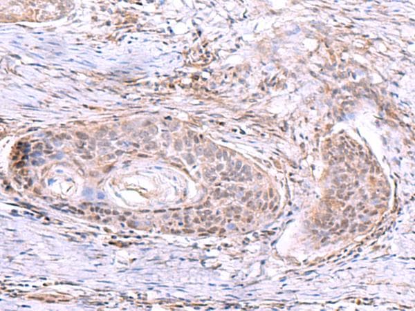 Polyclonal Rabbit anti-Human AKAP17A / 721P Antibody (IHC)