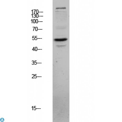 CLU / Clusterin Antibody