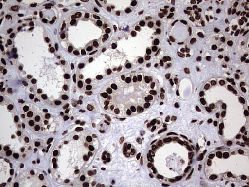 HNRNPL / hnRNP L Antibody (aa270-502, clone OTI9G7, Carrier-free)