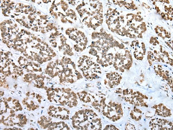 ZNF486 Antibody
