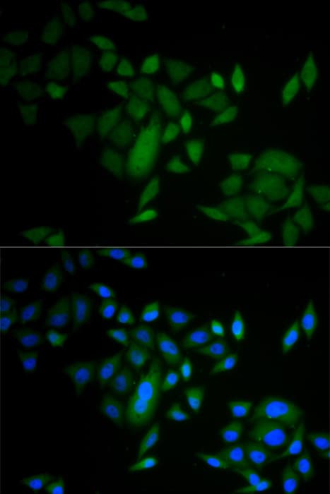 CASP9 / Caspase 9 Antibody