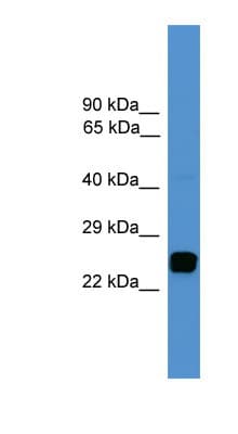 UCHL1 / PGP9.5 Antibody (C-Terminus)