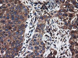 ERGIC-53 / LMAN1 Antibody (clone OTI1E3)