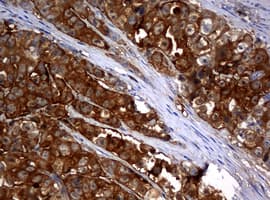 NME1 / NM23 Antibody (clone OTI7F6)