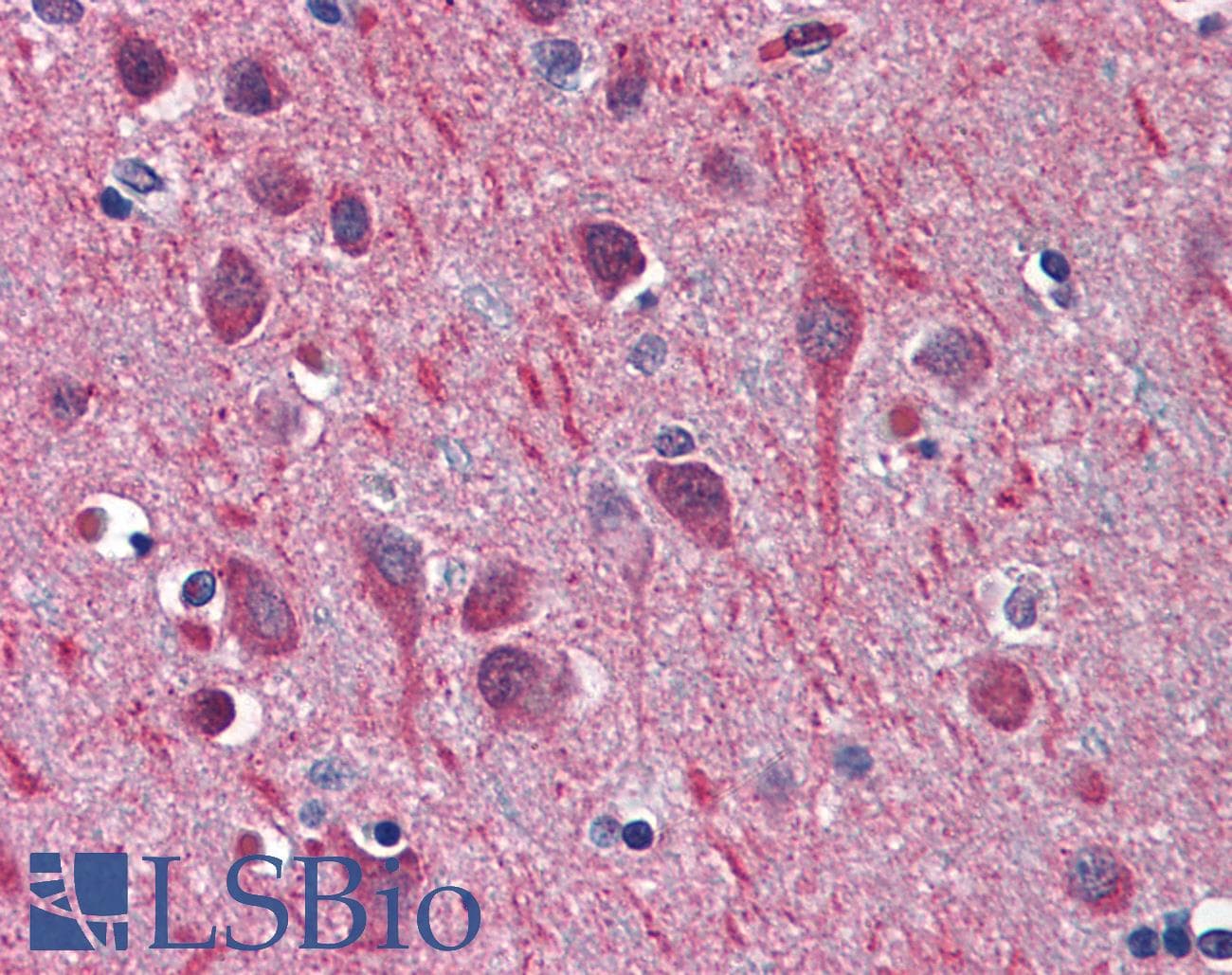 IHC-plus™ TUBB2A / Tubulin Beta 2A Antibody (clone 3C12)