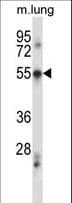 PDCD7 Antibody (aa390-419)