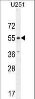 ACKR3 / CXCR7 Antibody (aa333-362)
