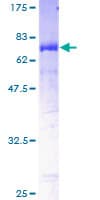 Human CATIP / C2orf62 Protein (Recombinant GST)