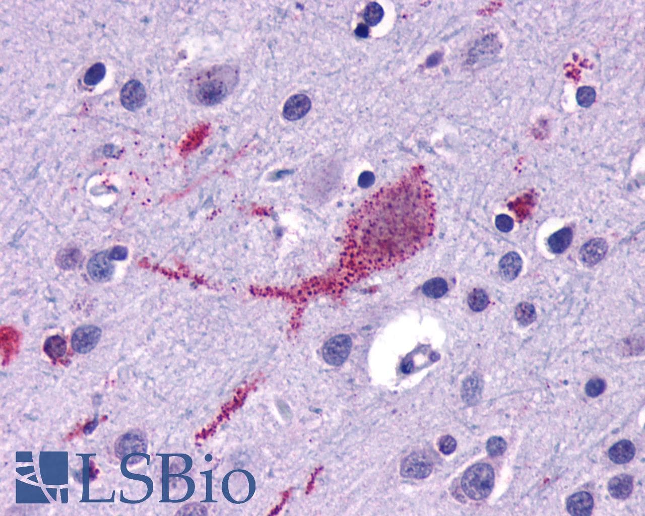 IHC-plus™ Polyclonal Rabbit anti-Human SMO / Smoothened Antibody (1st Extracellular Domain, IHC, IF)