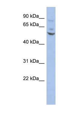 Polyclonal Rabbit anti-Human ER81 / ETV1 Antibody (C-Terminus, IHC, WB)