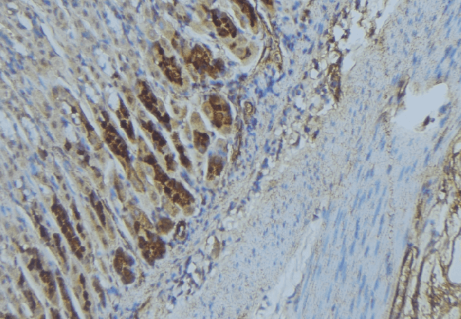IMMT / Mitofilin Antibody