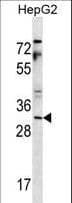 YAE1D1 Antibody (aa131-160)